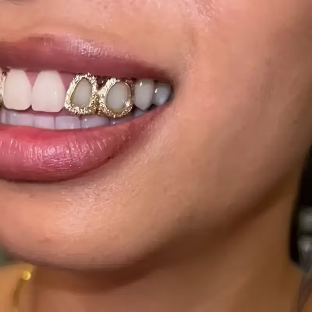 Set di 3 Accessori per Denti L - Street Fashion Jewelry recensione e prezzo